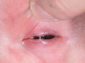 Congenital malformations 1