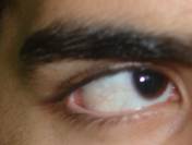 Congenital malformations 3