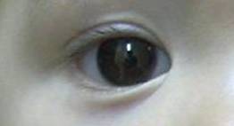 Congenital malformations 5