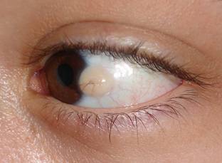 Congenital malformations 7