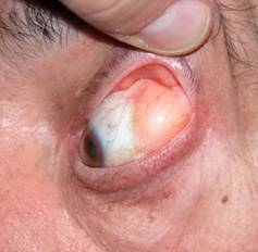 Congenital malformations 10