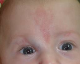 Congenital malformations 11