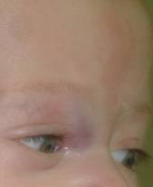 Congenital malformations 12