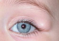 Congenital malformations 13