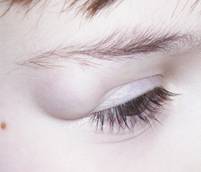 Congenital malformations 14