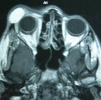 Congenital malformations 15