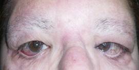 Congenital malformations 17