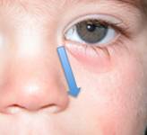 Tearing in the child 5