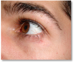 Stye Chalazion 6